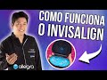 Como funciona o Invisalign | Invisalign passo a passo | Allegra Odontologia