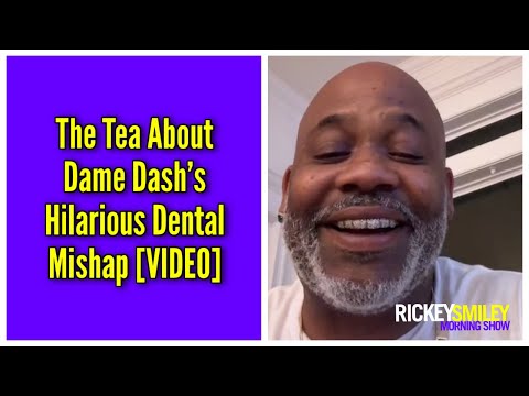 The Tea About Dame Dash’s Hilarious Dental Mishap