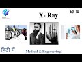 X-Rays: History, Uses & How They Work | Medical & Engineering Applications