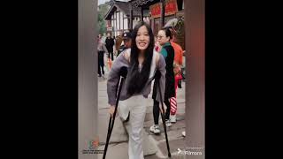 The Beautiful Woman Is An Amputee, Walking On An Artificial Leg And One Crutch #Amputee