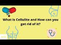 What is Cellulite and How can you get rid of it?