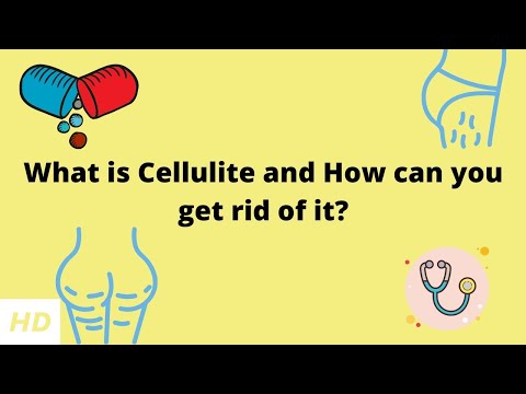 What is Cellulite and How can you get rid of it?