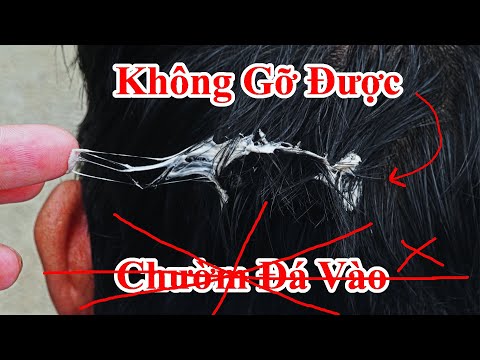 Video Ai Cũng Nghĩ Là Chườm Đá Vào Là Ra , Sai Hết Rồi ! 40... - youtube