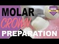 Molar Crown Preparation | Dental Crown Techniques