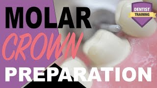 Molar Crown Preparation | Dental Crown Techniques