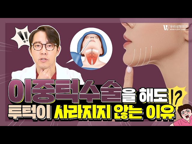 이중턱수술을 해도 투턱이 사라지지 않는 이유