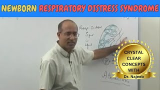 Newborn Respiratory Distress Syndrome | Pathophysiology🫁