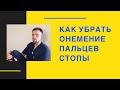 Как убрать онемение в пальцах стопы