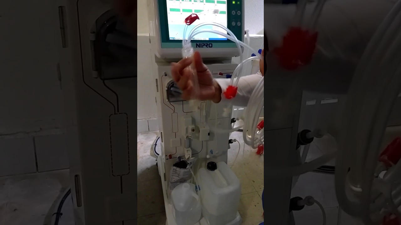 Hemodiálisis 1Nipro MáquinaPreparación