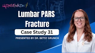 Case study 31 | Lumbar PARS Fracture | Presented by Dr. Betsy Grunch
