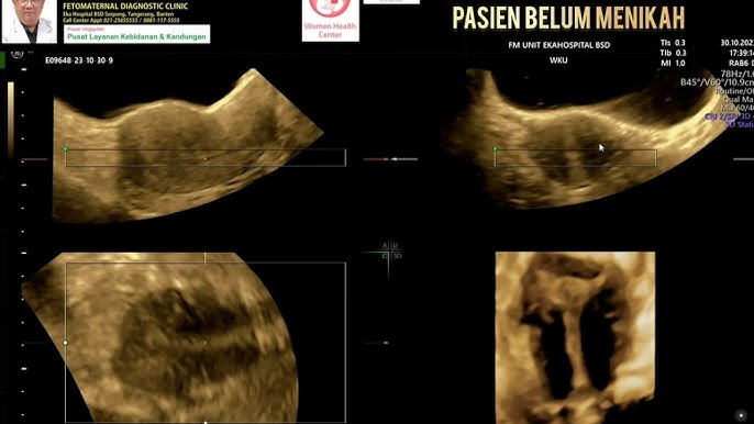 Yetuk turmushga chiqqan ayollar fotosuratlari Kichkintoylar tasmali video
