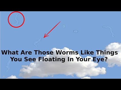 What Are Those Strange Things Floating In Your Eye? | Eye Floaters the worm that drifts across eyes.