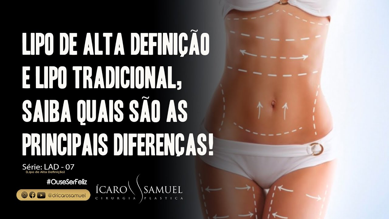 Cirurgia LAD 4D Lipo De Alta Defini o E Lipo Tradicional Conhe a As