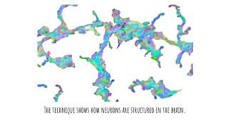 Leveraging technology to map the brain's neurons