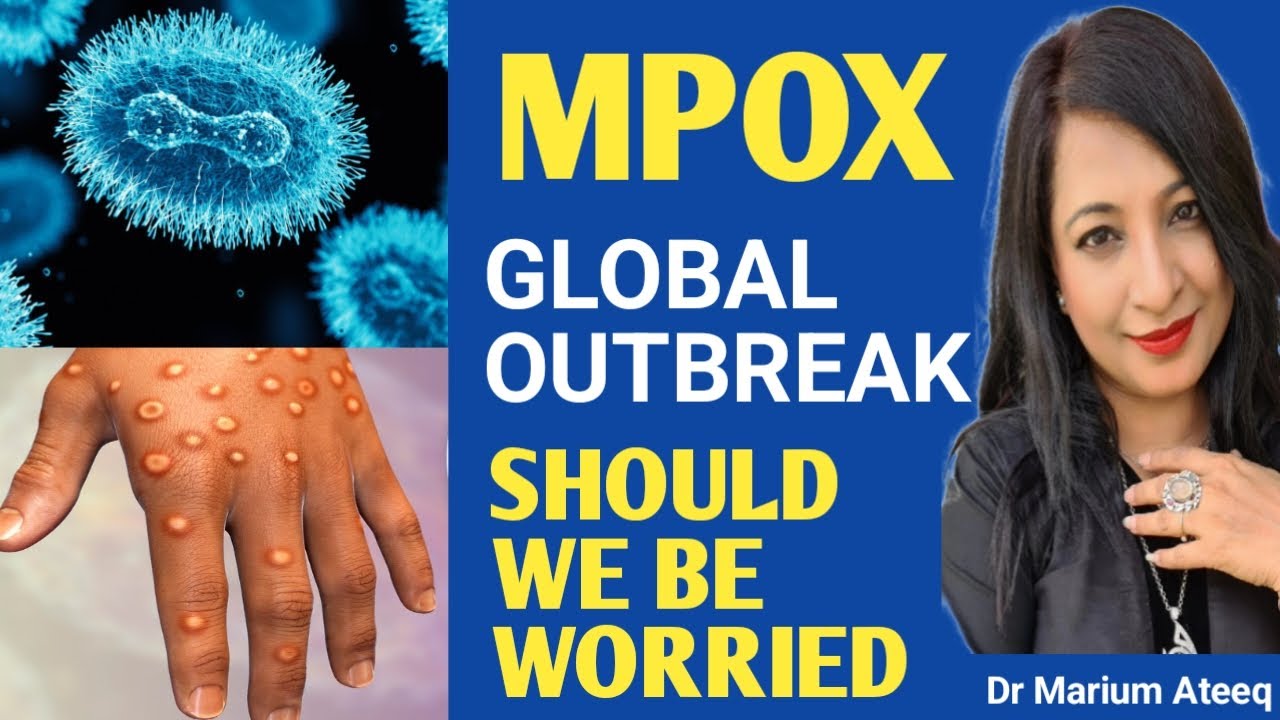 MPOX GLOBAL OUTBREAK | CAN MPOX BECOME THE NEW COVID?