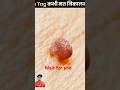 Skin Tag कभी मत निकालना 🙅♂️ pasravge hamesha | The Fact | #shorts #ytshorts kabhi mat nikal na