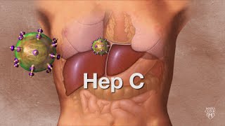 Mayo Clinic Minute: ABCs of hepatitis