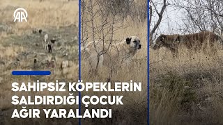 Sahipsiz Köpeklerin Saldırdığı Çocuk Ağır Yaralandı