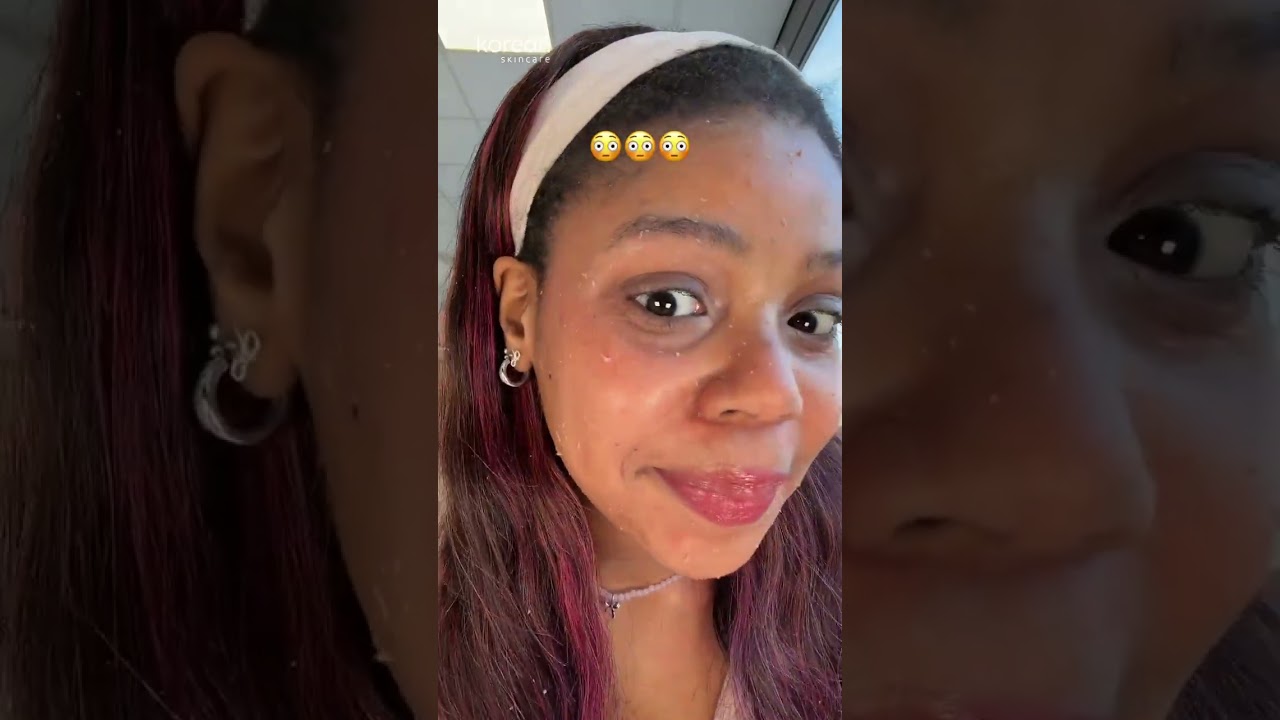 Dr.Melaxin Peel Shot Exfoliating Kojic Acid Turmeric Serum 🧡✨️