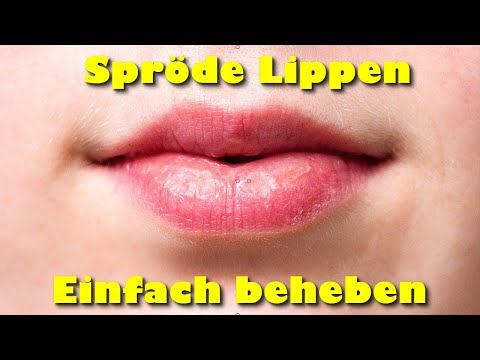 Video: Wie Man Trockene Lippen Pflegt