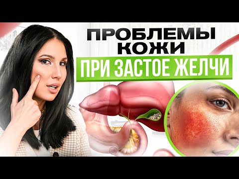 10 признаков застоя желчи на коже. Что кожа расскажет о твоем желчном?