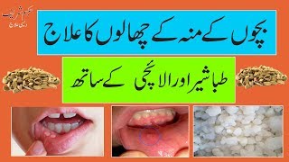 bacho k mu k chalo ka | Mouth Blisters | ilaj in urdu and hindi