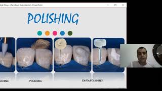 anterior composite tips and  tricks