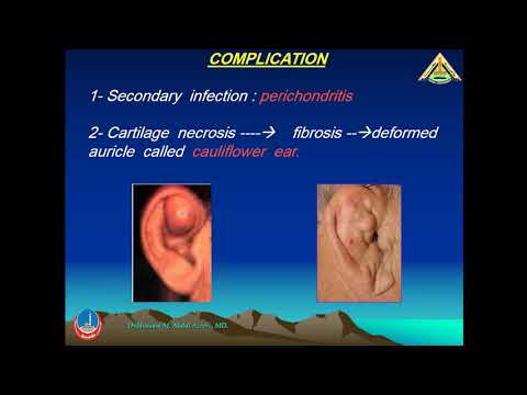 4 trauma of auricle, EAC, TM