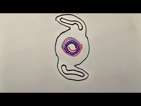 Akıllı Mercek Ameliyatında Bazı Hastalar Neden Mutsuz?