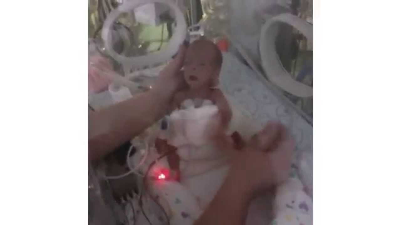 Aferrada A La Vida Maria Bebe Prematuro 26 Semanas 432 Gramos Youtube