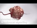 Cancer Cell Biology Mutated KRAS Reciprocal Signalling mp3