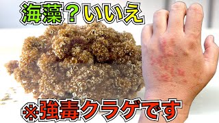 海藻にしか見えない毒クラゲ!「イラモ」に刺されるとこうなりますから皆様ご注意ください【黒潮生物研究所コラボ】