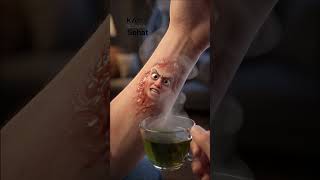 Obat Herbal