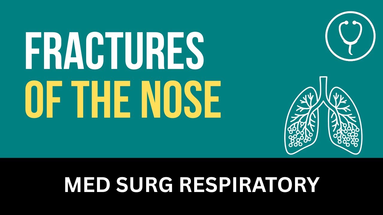 Fractures of the Nose - Nursing Lecture - Chapter 18