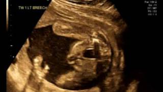 20_Weeks_1a.avi