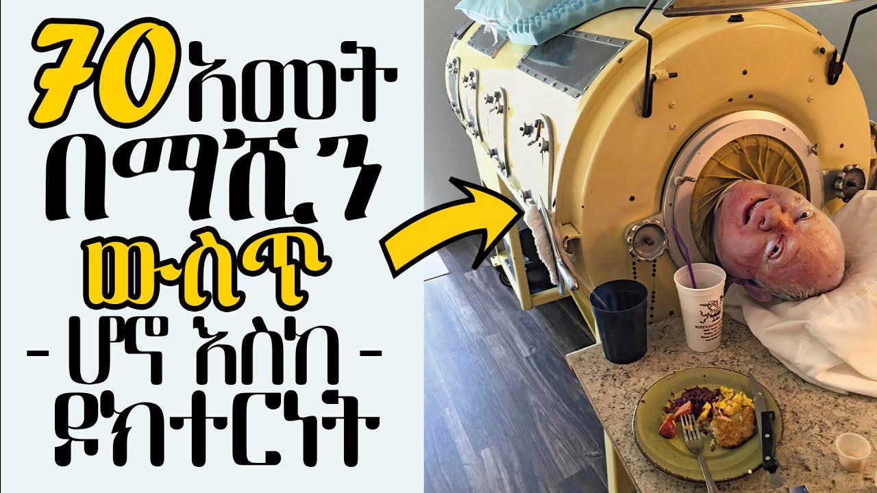 ከ 70 አመት በላይ በማሺን ውስጥ የተቆለፈበት ሰው! Paul Alexander iron lung man
