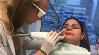 Laser Hair Removal Schweiger Dermatology Group