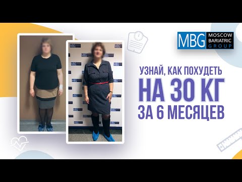 6 месяцев после рукавной гастропластики | Отзыв пациентки