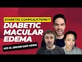 Diabetes Complications - Diabetic Macular Edema with Dr. Jonathan David Tijerina