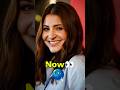 Anushka Sharma 90s actress Then and Now 😱 || #shortvideo #bollywood #facts #anushkasharma #shorts