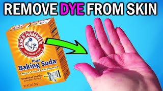 How to Remove Hair Dye from Skin | 10 Best Ways to Remove Hair Dye | How to get Hair Dye off Skin by Natural Health Remedies 1,034 views 2 months ago 6 minutes, 53 seconds