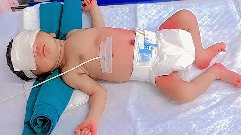 Newborn cute baby jaundice treatment on photography lights in Nicu 🚼👨‍⚕️🏥