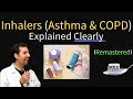 Asthma & COPD Treatment / Pharmacology (Inhaler Progression)