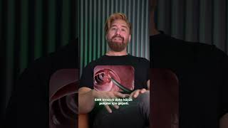 Bağirsak Poli̇pleri̇bde Emr Mi̇? Esd Mi̇? Resimi