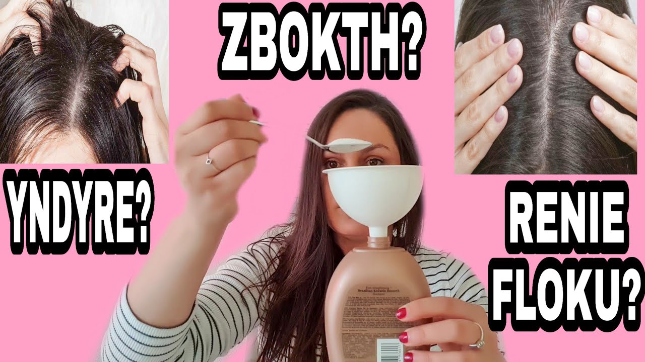 ZGJIDHJA ME E MIRE PER RENIEN  FLOKEVE / ZBOKTHIN /YNDYREN /VETEM NE 1 JAVE