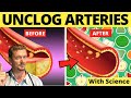 Top Foods to Clean Arteries &amp; Prevent Heart Attack! (Sarcasm Alert!)