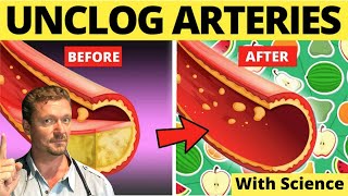 Top Foods to Clean Arteries & Prevent Heart Attack! (Sarcasm Alert!) screenshot 4