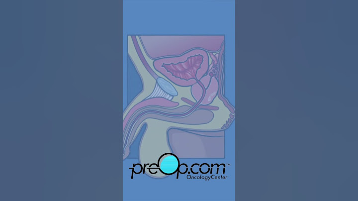 🔍 PreOp® Robotic Assisted Prostatectomy Patient Ed 💡Sharpen Your OR Readiness✨ #shorts