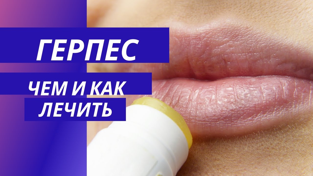 Герпес На Губе Можно Заниматься Сексом