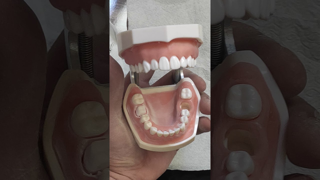 المحاضرة الأولى (تعويضات ثابتة) عملي القسم السادس